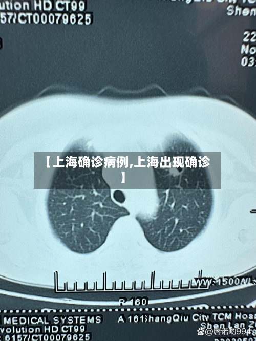 【上海确诊病例,上海出现确诊】-第3张图片